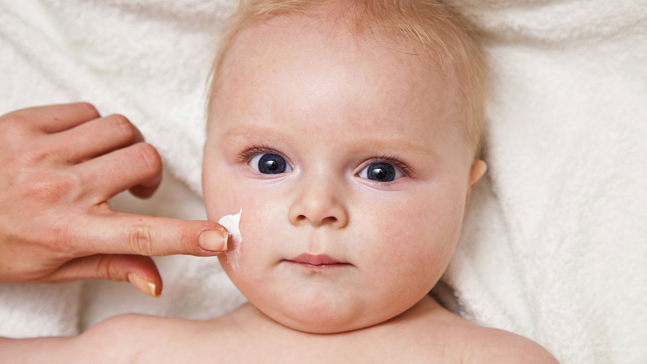 Thuốc điều trị mụn sữa ở trẻ sơ sinh